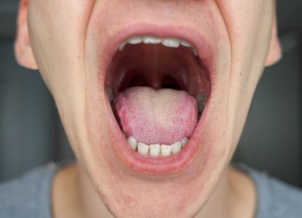 Mies on avannut suunsa apposelleen ja hampaat näkyvät.