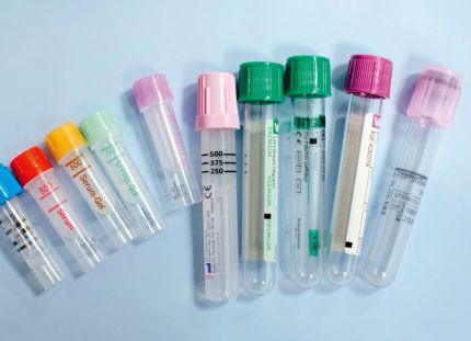 Metropolian bioanalyytikko-opiskelijat aloittavat näytteenoton omalla kampuksellaan. Näytteenottoputkia pöydällä.