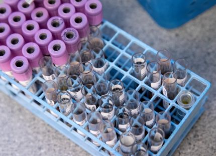 Koko pohjoisen Suomen laboratoriopalveluista vastaava NordLab hyvinvointiyhtymä aloittaa yt-neuvottelut. Verinäyteputkiloita telineessä.