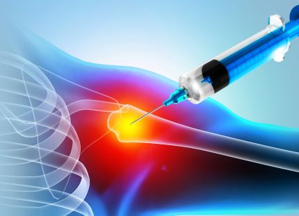 Kuvituskuva olkapäästä, johon pistetään kortisonia.